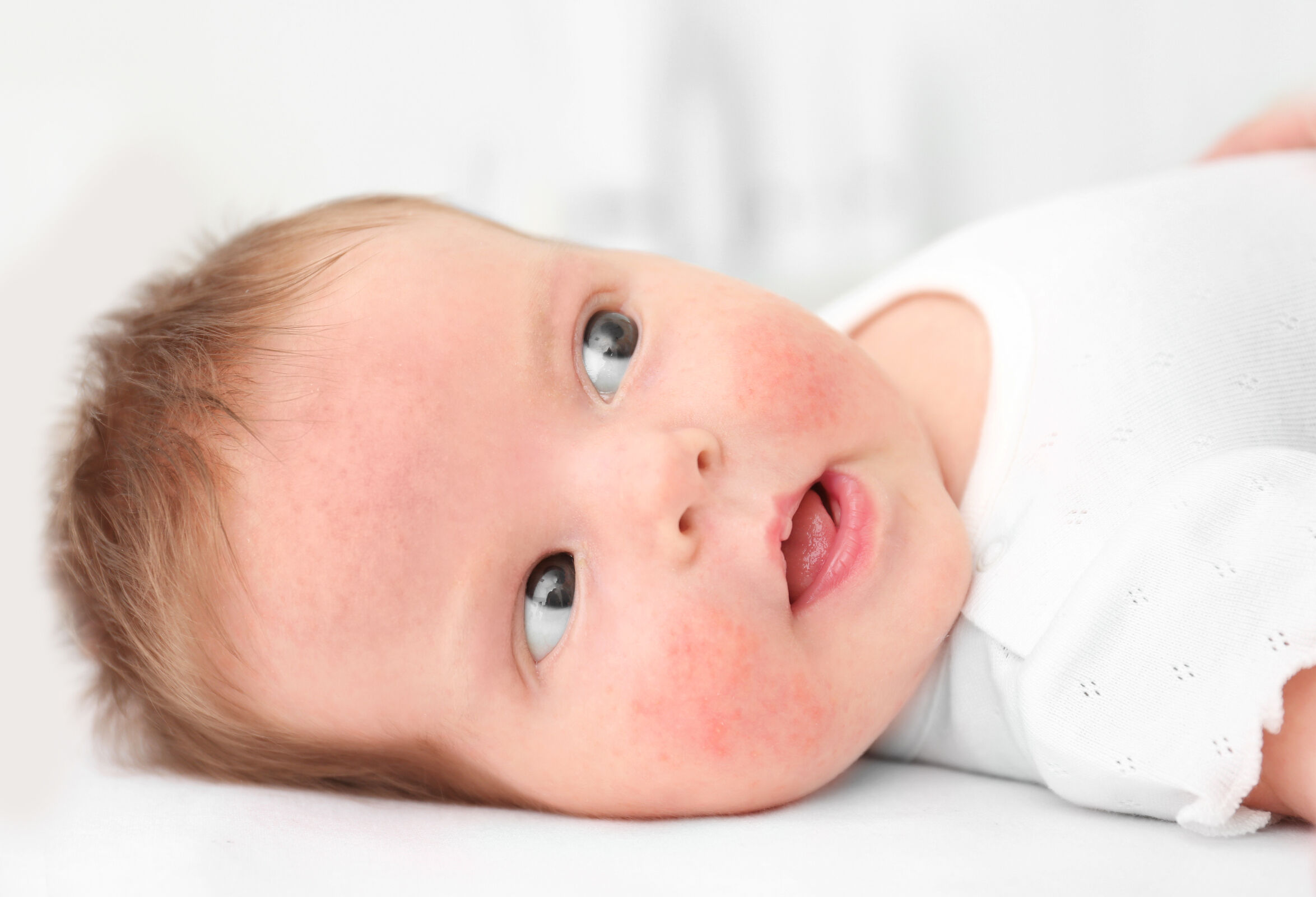 Giải đáp thắc mắc: Viêm da ở trẻ sơ sinh có nguy hiểm không?